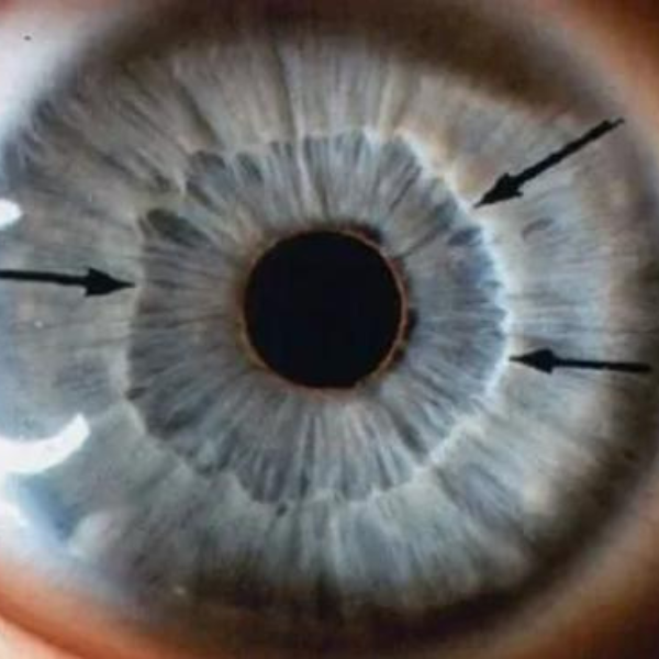 iridology amtherapies